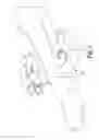 Fig. 02 - Double eccentric positioning apparatus