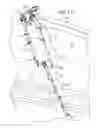 Fig. 15 - Double eccentric positioning apparatus