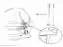 Fig. 01 - MOUNTING BRACKET