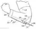 Fig. 01 - ARM SLEEVE WITH RETRACTABLE ELBOW SPIKE