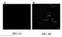 Fig. 08 - Image analysis and measurement of biological samples