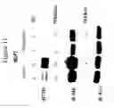 Fig. 12 - METHODS FOR PREDICTING THE RADIOSENSITIVITY OF A CANCER TUMOR AND METHODS OF TREATING CANCER
