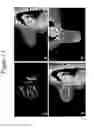 Fig. 14 - METHODS FOR PREDICTING THE RADIOSENSITIVITY OF A CANCER TUMOR AND METHODS OF TREATING CANCER