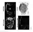 Fig. 09 - Small molecule detection and localization method based on MALDI imaging mass spectrometry