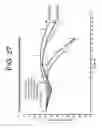 Fig. 33 - Methods of aiding in the diagnosis of diseases using anti-IL-6 antibodies