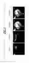 Fig. 05 - Magnetic resonance imaging method and apparatus with motion-corrected model-based acceleration of parameter mapping