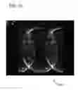 Fig. 12 - Propeller magnetic resonance imaging