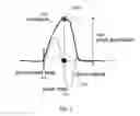 Fig. 03 - Downhole caliper using multiple acoustic transducers