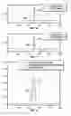 Fig. 10 - Method for filtering for interpretation of neutron induced gamma ray measurements