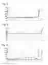 Fig. 07 - Compact balance spring of constant section
