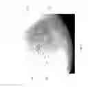 Fig. 08 - Sweat pores imaging method and device