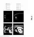 Fig. 05 - Viewpoint recognition in computer tomography images