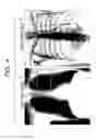 Fig. 04 - MEDICAL IMAGE PROCESSING DEVICE AND PROGRAM
