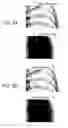 Fig. 05 - MEDICAL IMAGE PROCESSING DEVICE AND PROGRAM