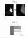 Fig. 10 - MEDICAL IMAGE SYSTEM AND COMPUTER READABLE RECORDING MEDIUM