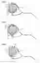 Fig. 03 - Method, apparatus and computer program for visually supporting a practitioner with the treatment of a target area of a patient