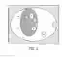 Fig. 04 - Tumor segmentation and tissue classification in 3D multi-contrast