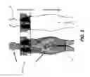 Fig. 04 - APPARATUS AND METHOD FOR SCATTERED RADIATION CORRECTION
