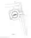 Fig. 04 - One time use tag