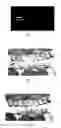 Fig. 04 - Parking space detection apparatus and method, electronic apparatus
