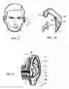 Fig. 02 - External ear insert for hearing comprehension enhancement