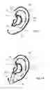 Fig. 03 - External ear insert for hearing comprehension enhancement