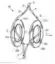 Fig. 01 - Forming an electrical coil device by cutting a strip conductor winding into at least two partial coils