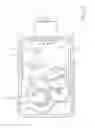 Fig. 11 - Driving device with stepper motor