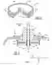 Fig. 03 - MLCC filter on an AIMD circuit board having an external ground plate adjacent to the hermetic seal insulator