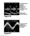 Fig. 26 - Method and apparatus to evaluate audio equipment for dynamic distortions and or differential phase and or frequency modulation effects