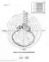 Fig. 21 - METHOD AND DEVICE FOR SAME BAND CO-LOCATED RADIOS