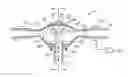 Fig. 01 - Air seeder manifold with improved distribution uniformity