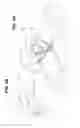 Fig. 03 - Three headed cutting apparatus for attachment to a lawnmower tractor