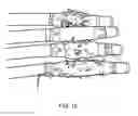 Fig. 12 - PREVENTION OF ROOT INTRUSION IN SUB-SURFACE STRUCTURES