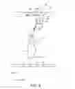 Fig. 05 - Shoulder-blade incision-making apparatus