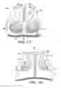 Fig. 17 - Flat-knit support garment for upper torso