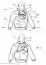 Fig. 02 - Garment Having Integral Head and Face Protective Hoods