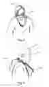 Fig. 04 - Garment Having Integral Head and Face Protective Hoods