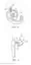 Fig. 03 - Charm and clothing attachment device