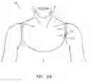 Fig. 06 - Charm and clothing attachment device