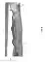 Fig. 05 - Wearable tissue holder