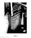 Fig. 07 - COLLAPSIBLE HANGING SHOE RACK
