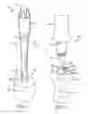 Fig. 02 - FLUID DISPENSING CLEANING TOOL