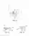 Fig. 02 - LUMEN TRAVELING DEVICE
