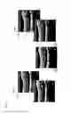 Fig. 07 - Systems and methods for retinal layer segmentation in OCT imaging and OCT angiography