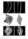 Fig. 09 - Systems and methods for retinal layer segmentation in OCT imaging and OCT angiography
