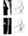 Fig. 05 - System and method for classifying and quantifying age-related macular degeneration