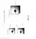 Fig. 46 - Optical coherence tomography-based ophthalmic testing methods, devices and systems