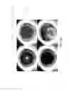 Fig. 57 - Optical coherence tomography-based ophthalmic testing methods, devices and systems