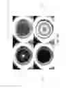 Fig. 58 - Optical coherence tomography-based ophthalmic testing methods, devices and systems